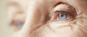 How Do Cataracts Affect My Vision?