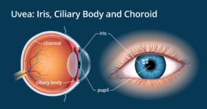 iris of eye diagram - Louisiana Eye & Laser Center