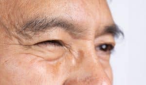 Senior man eye strain after for long stretches at digital screens. eyelid twitching